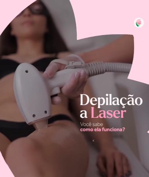 Procedimento de Depilação a Laser